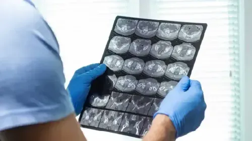 What is the Typical Price Range of a Head MRI Scan?